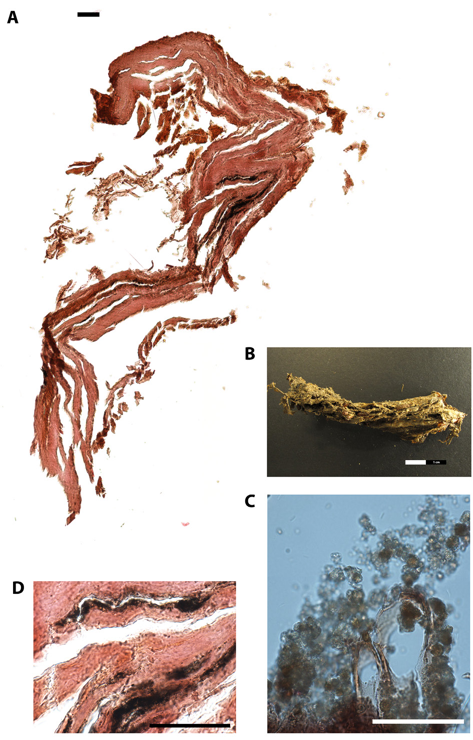 Paraffin cross-section of internal tissue of the mummified individual (EURAC-ID 1526).