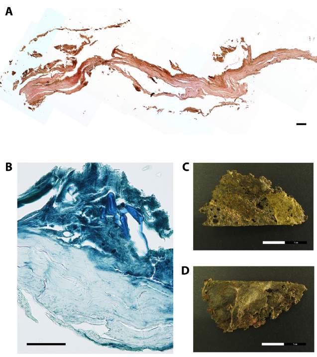 Paraffin cross-section of skin tissue of the thoracic back side of the mummified individual (EURAC-ID 1522).