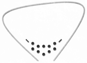 Botulino toksino A injekcijų į trikampio sritį vietos (į kiekvieną tašką suleista po 10 V botulino toksino A) (adaptuota pagal Pinto, 2010 [17])