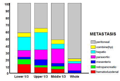 Pattern of metastasis according to tumor location (based on the gastric cancer location, metastasis to the para-aortic lymph nodes was more common in upper-third cancer, and that to hepatoduodenal lymph nodes was more common in lower-third cancer; peritoneal dissemination was more common in patients with cancer involving the entire stomach)