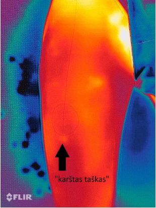 Termograma, užfiksuota praėjus 2 min. po „šalčio iššūkio“ (pastebimas vienas „karštas taškas“ ties apatine tiriamosios zonos riba)