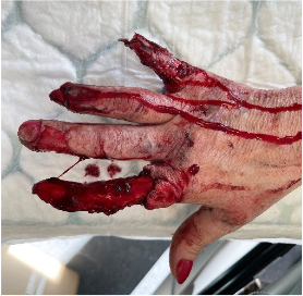 Preoperative state