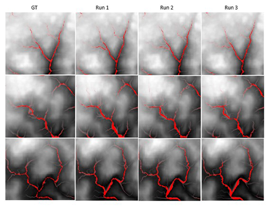 DEMs containing the drainage channels results for the images generated by the Runs 1, 2 and 3 in comparison to the high-resolution images. GT: Ground Truth.