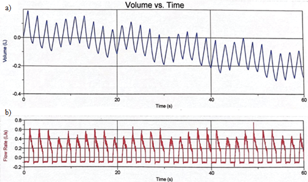 Lung Volume Measurements variable a Tidal Volume b Flow rate and 11 IE ratio