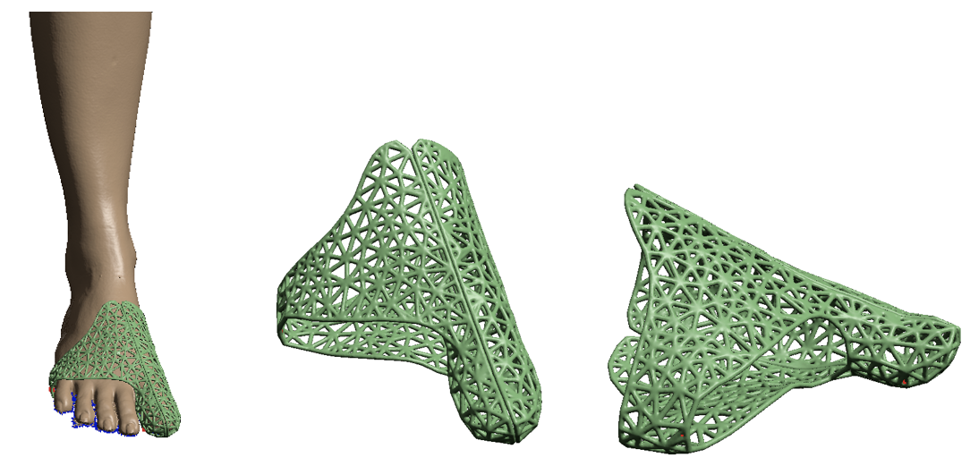 Prototipo de ortesis para el hallux.