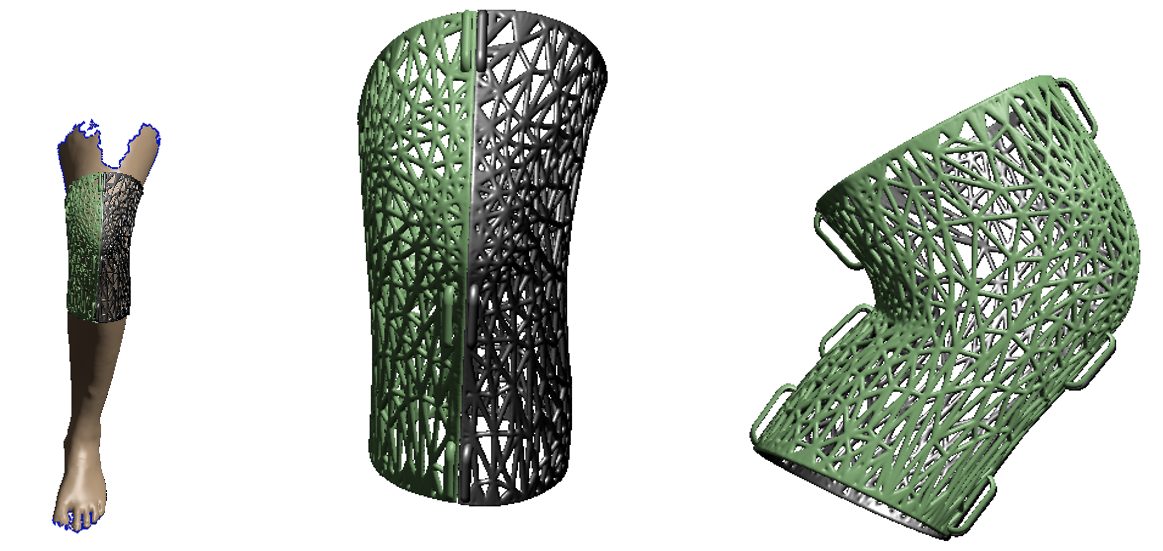 Prototipo de ortesis para la rodilla.