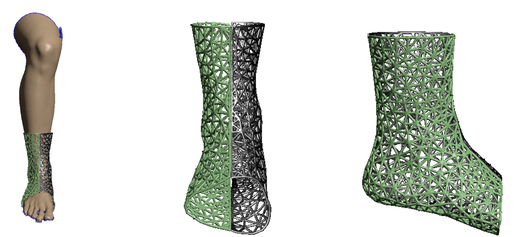 Prototipo de ortesis para el tobillo 1.