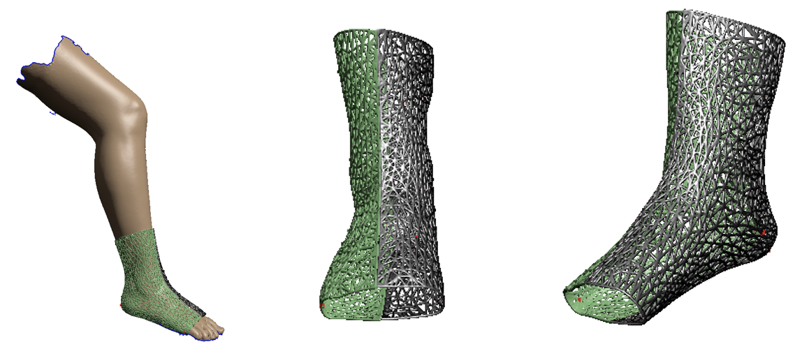 Prototipo de ortesis para el tobillo 2.