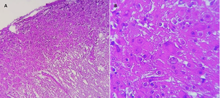 Imágenes anatomopatológicas.