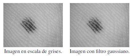 Aplicaci&oacute;n de filtro gaussiano a nevus uni&oacute;n.
