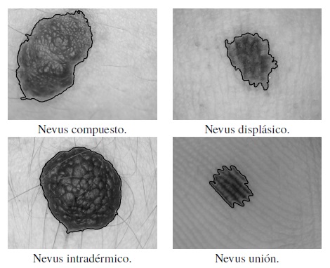 Muestra del contorno capturado.