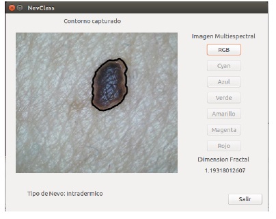 Ventana de
resultados