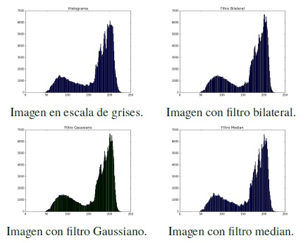 Histograma de un nevus
compuesto.