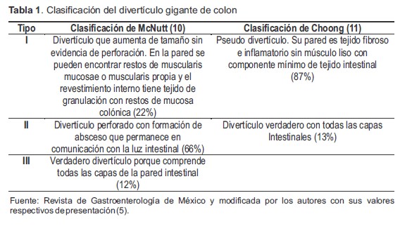Clasificaci&oacute;n del divert&iacute;culo gigante de colon