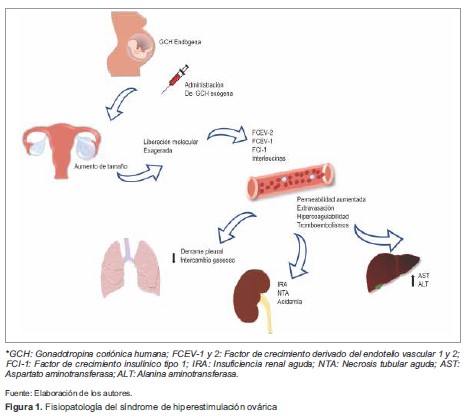 Fisiopatolog&iacute;a del s&iacute;ndrome de hiperestimulaci&oacute;n ov&aacute;rica