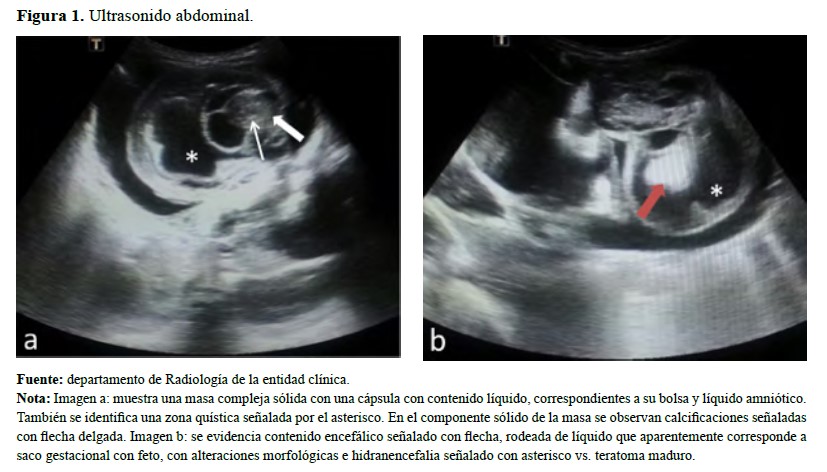 Ultrasonido abdominal