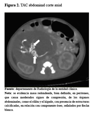 TAC abdominal corte axial