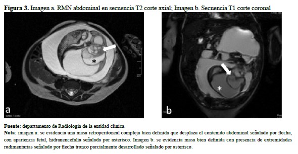Imagen a RMN abdominal en secuencia T2 corte axial Imagen b Secuencia T1 corte coronal