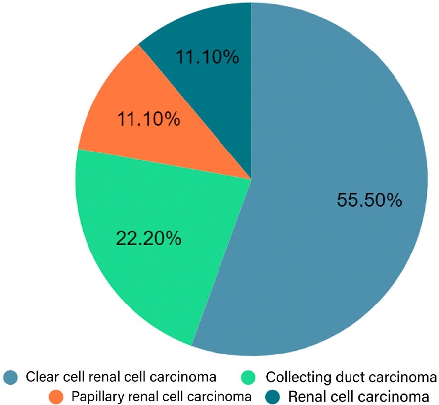 Distribution of tumors of primary origin in neoplasms of metastatic origin.