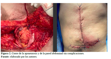 Figura 2. Cierre de la aponeurosis y de la pared abdominal sin complicaciones.