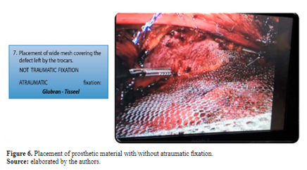 Figure 6. Placement of prosthetic material with/without atraumatic fixation.