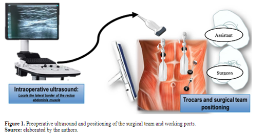 Figure 1. Preoperative ultrasound and positioning of the surgical team and working ports.