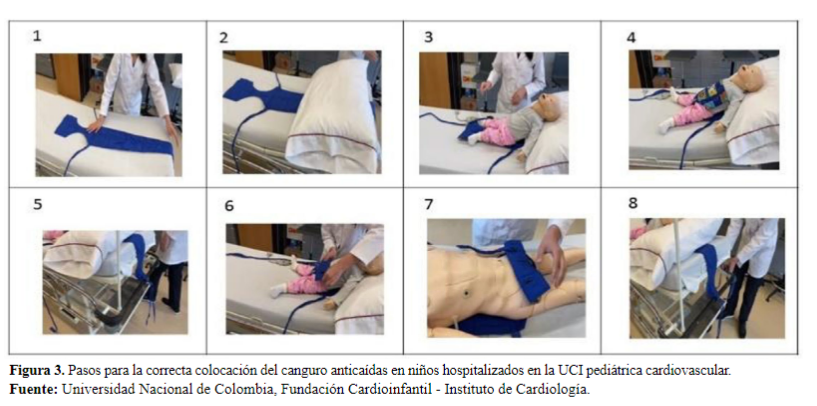 Figura 3. Pasos para la correcta colocaci�n del canguro antica�das en ni�os hospitalizados en la UCI pedi�trica cardiovascular.
