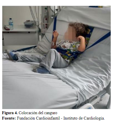 Figura 4. Colocaci�n del canguro