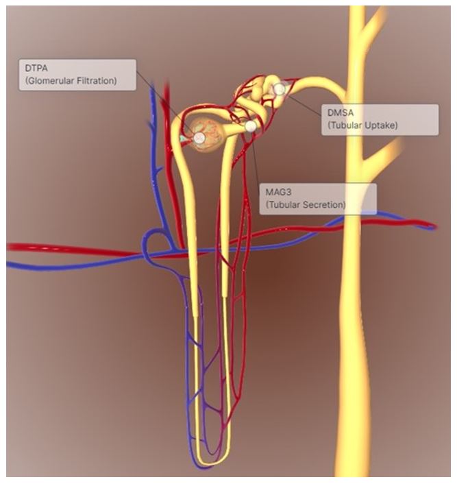 Illustration of a nephron and  distribution of each tracer. [99mTc]TcDTPA2- glomerular  filtration at the glomerulus; [99mTc]TcMAG32 proximal tubule  secretion; and [99mTc]TcDMSA2- proximal and distal  tubular uptake. Image prepared using the web-based software BIODIGITAL - The  BioDigital Human Platform, version 4.0 (available at:  https://human.biodigital.com/explore).