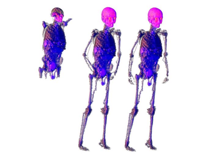 Views of the VOXEL_MAN, MAN_TISSUE3-6 and VOX_TISSUE8 phantoms.