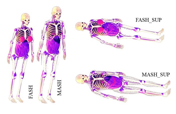Views of FASH, MASH, FASH_SUP and MASH_SUP phantoms.