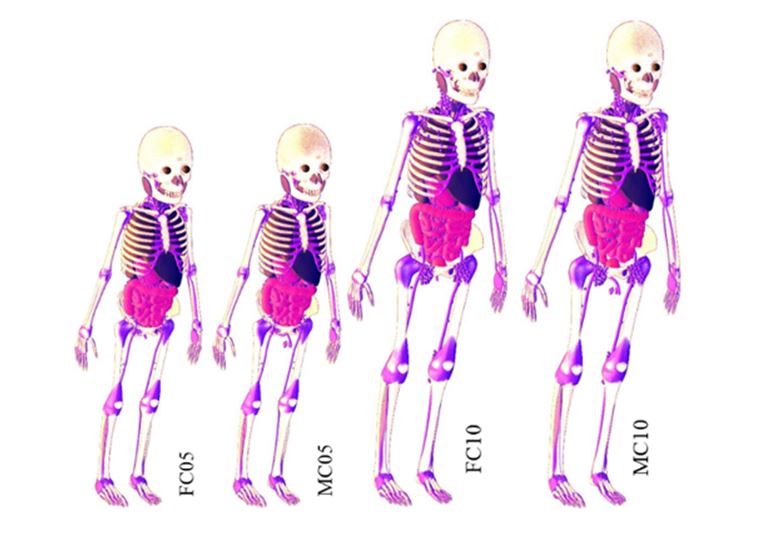 GDN pediatric phantoms.