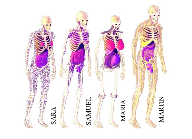 GDN teen and adult phantoms.