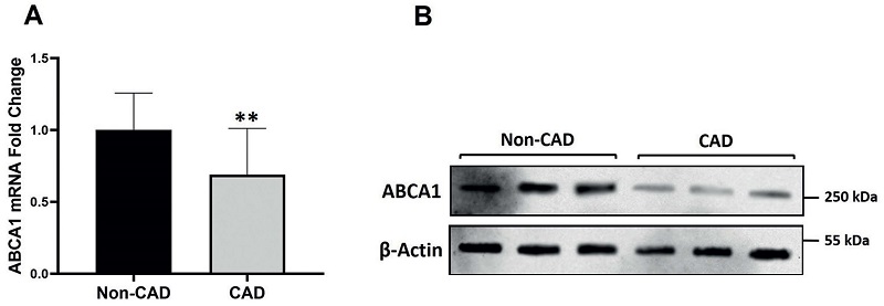 The mRNA (A) and protein (B) expression levels of ABCA1 in PBMCs of CAD and non-CAD groups were assessed by qRT-PCR and Western blotting, respectively. The data are presented as mean &plusmn; SD (** p < 0.01)
								