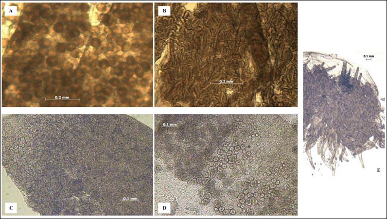 Estados de madurez sexual seg&uacute;n el tejido gon&aacute;dico de Stomolophus meleagris. A) hembra madura, B) macho maduro, C) hembra inmadura, D) macho inmaduro y E) organismo indeterminado [8].