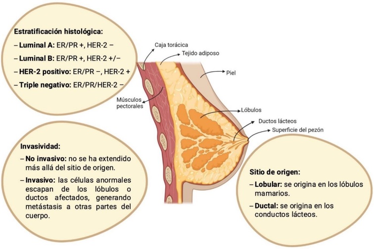 Clasificaciones del c�ncer de mama.
