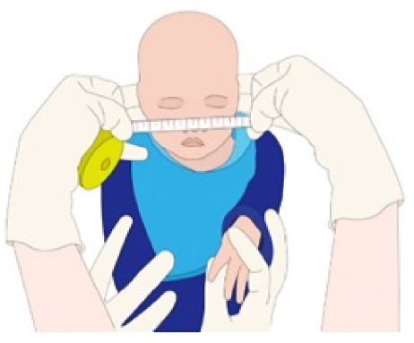Measurement Technique. Bizygomatic Distance