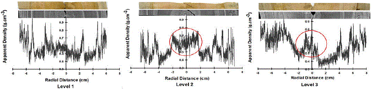 Density profi les and digital x-ray images according to physiological disorder level.