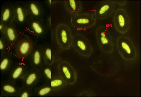 Sangre de Chen caerulescens, Eritrocito policrom&aacute;tico (EPC), Eritrocito con prolongaci&oacute;n nuclear (EPN), Tinci&oacute;n: anaranjado de acridina (100x).
