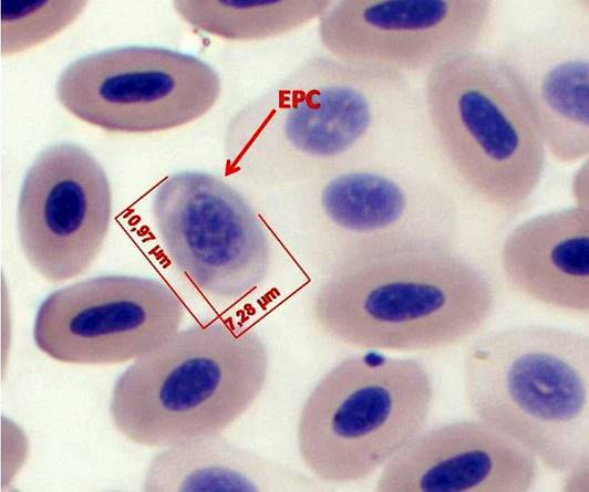 3. Sangre de Chen caerulescens, Eritrocito policrom&aacute;tico (EPC), Tinci&oacute;n Wrigth-Giemsa (100x).