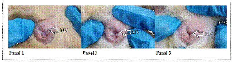 Apertura de la membrana vaginal. Panel 1: MV=membrana vaginal cerrada 0%. Panel 2: membrana vaginal semi abierta en 50%. Panel 3: membrana vaginal abierta 100%.