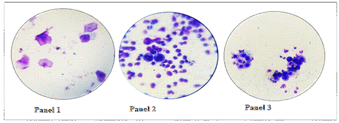 5. Presencia de diferentes tipos de células desde la apertura de la membrana vaginal (25%) hasta el cierre de la misma. Panel 1: Presencia de células superficiales (celo). Panel 2: aparición de gran cantidad de neutrófilos (ovulación). Panel 3: Células parabasales (metaestro).