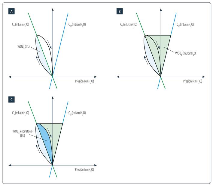 Diagrama de Campbell y sus componentes. A. El área celeste claro, a la derecha de la pendiente de CP, corresponde al WOBR. B. El triángulo verde claro representa el WOBE. C. El área azul, a la derecha de la pendiente de CP, representa el WOBR espiratorio. En la Figura B, nótese que el triángulo azul se encuentra dentro del verde.