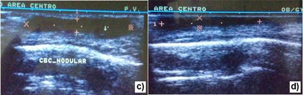 Evaluacin ecogrfica del paciente de la figura 1.