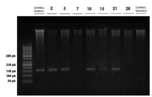 Electroforesis en gel de
agarosa B.P.F. al 3% en 7 muestras de amplificados para SRY de sangre de
terneras nacidas por parto m&uacute;ltiple heterosexual en Colombia.