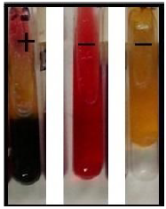 Interpretacon para TSI.