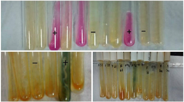Interpretación de los medios Urea y FAD.