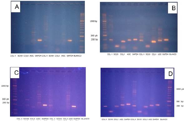 Patrón de expresión marcadores moleculares. A. Muestras de células sembradas sobre fibroína con medio de expansión. B. Muestras de células sembradas sobre fibroína con medio condrogénico. C. Muestras de células sembradas sin fibroína con medio de expansión. D. Muestras de células sembradas sin fibroína con medio de condrogénico.