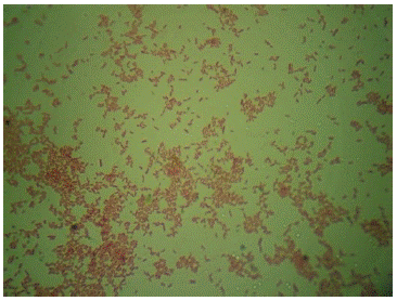 Observación al microscopio de tincón de Gram ( 100X)