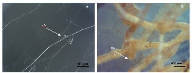 /n v/tro R. irregularis spore's production after sub-cultivation. A: Newly formed spores (nfs) after 25 days of culture (30X). B: Mature spores (ms) after 95 days of incubation (30X).